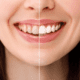 Close-up of a smile showing teeth discoloration and stains, with a focus on understanding causes and treatment options for a brighter smile.